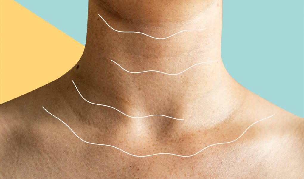 Frustrating Neck Lines And Best Treatment Options For You